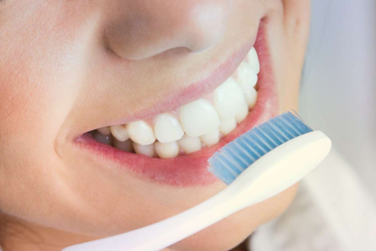 Советы по успешному отбеливанию зубов